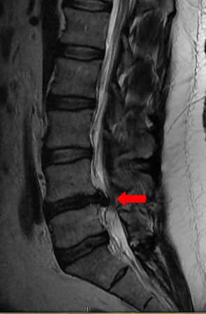 mri-small.jpg